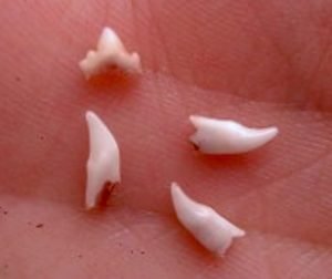 Baby teeth that have fallen out
