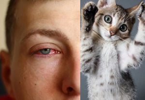 Allergy to cats