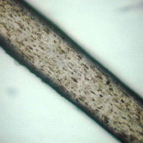 Melanin granules in a hair shaft
