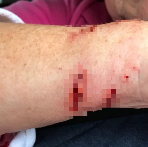 Gash on the arm allegedly caused by a Bengal cat