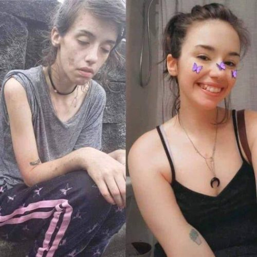 Before and after photo of a herion addict who cleaned up with the help of 2 cats and her family